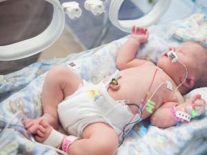 A newborn baby in an incubator