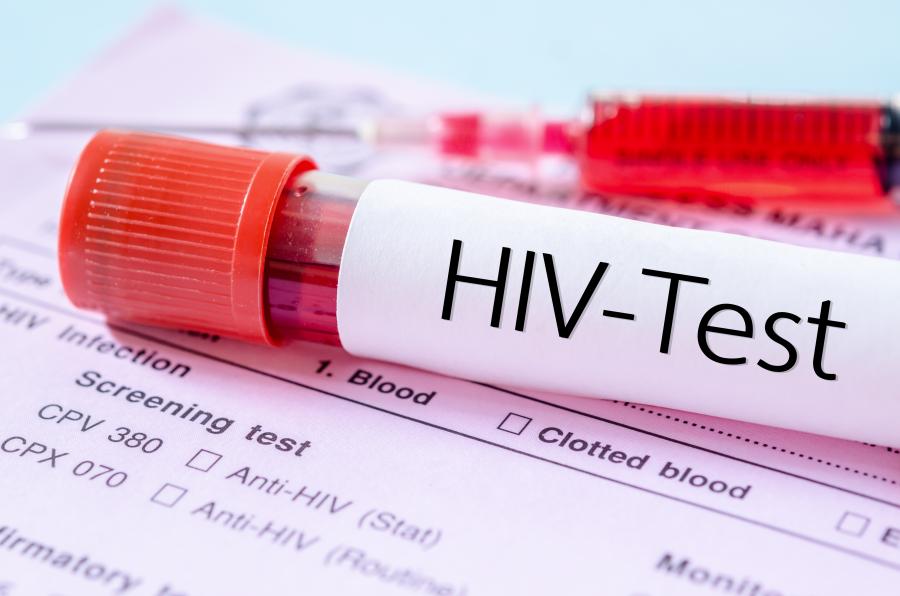 new research about hiv